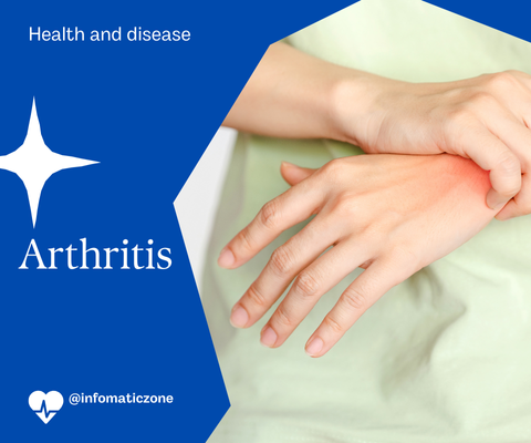 Arthritis: Types, Signs, and Effective Treatments